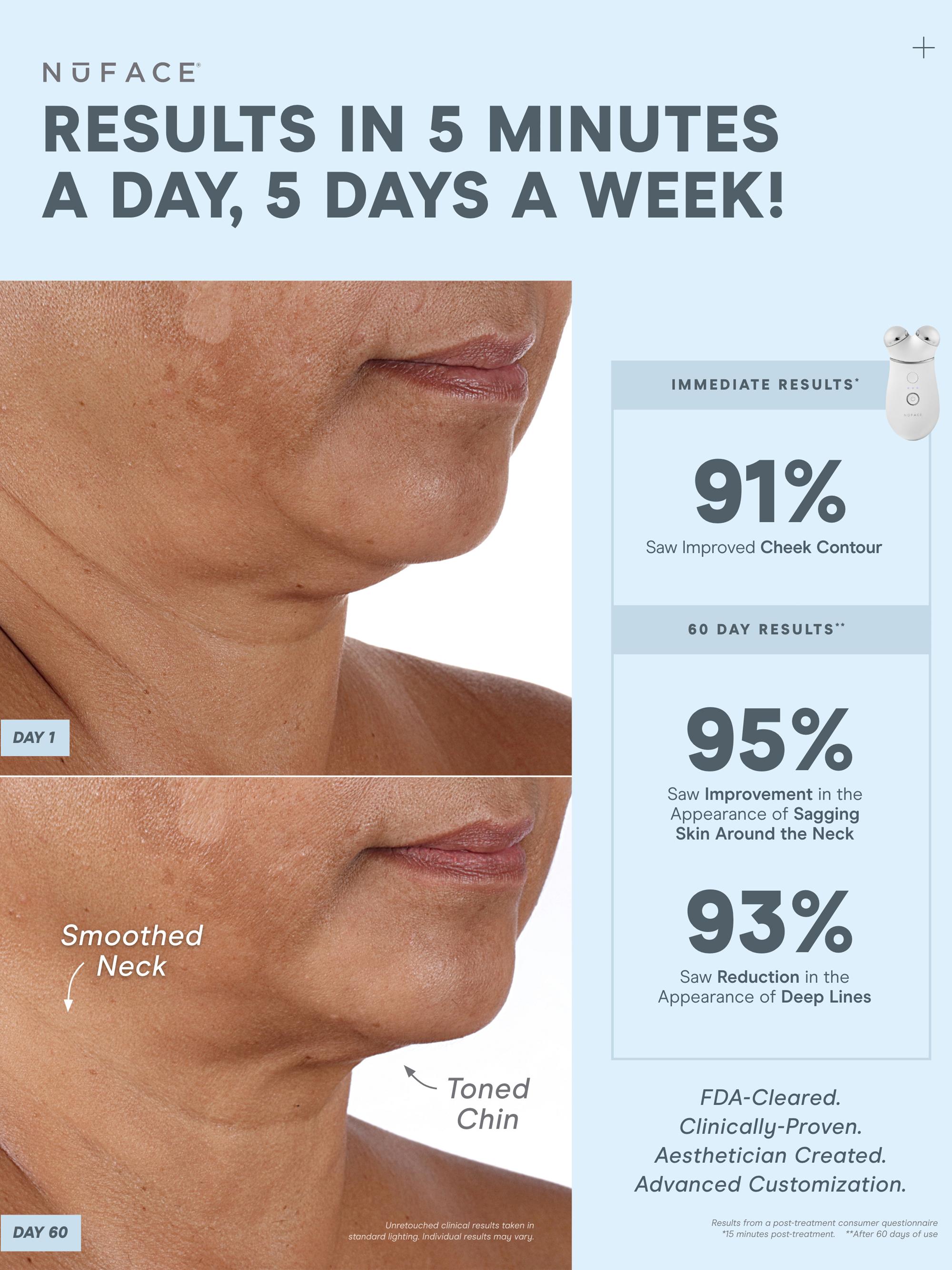 NU SKIN セット NuFace Trinity+ Smart Advanced Facial Toning Routine 4-Piece Set