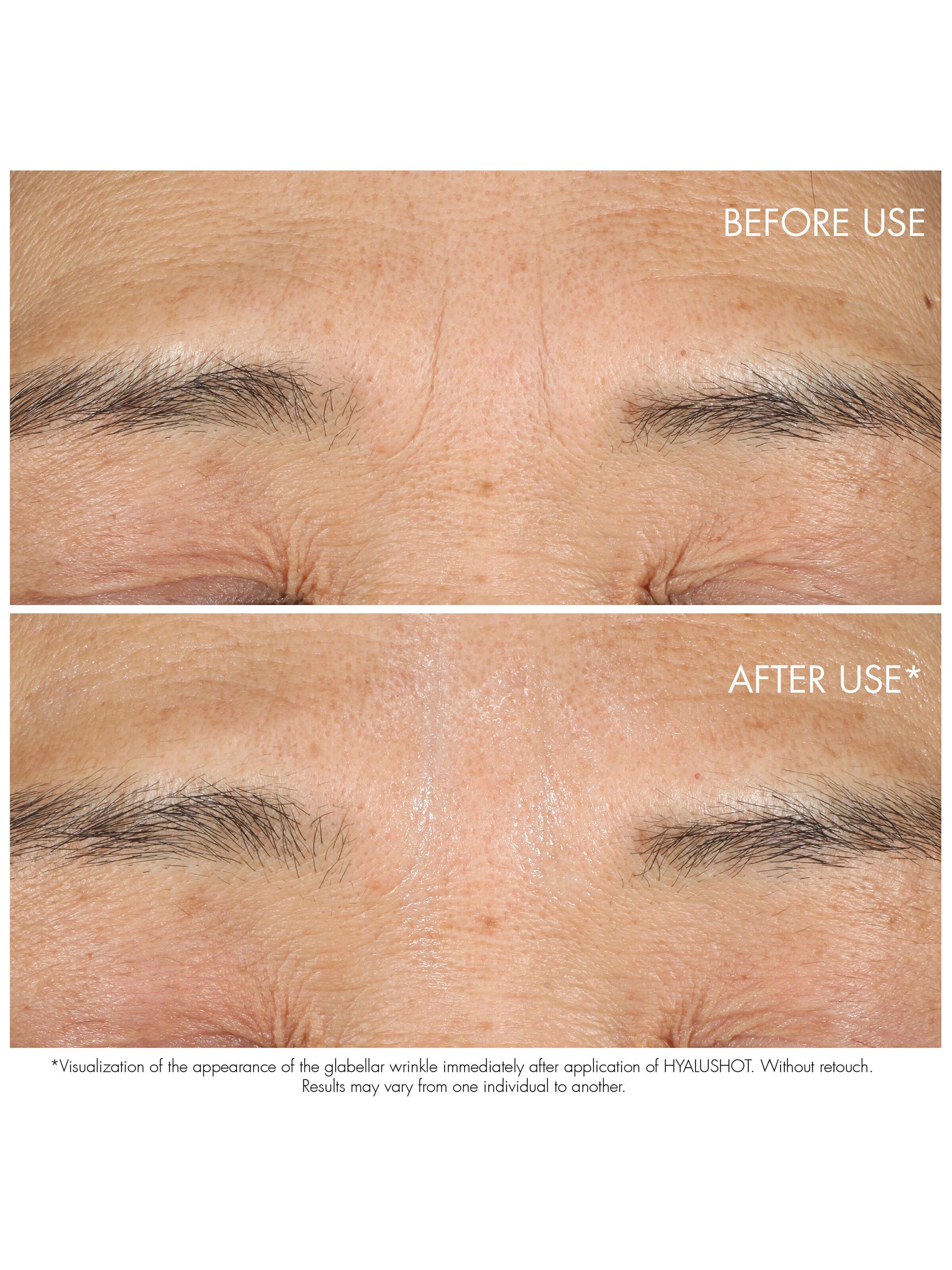 DIOR Dior Capture Totale Hyalushot: Wrinkle Corrector With